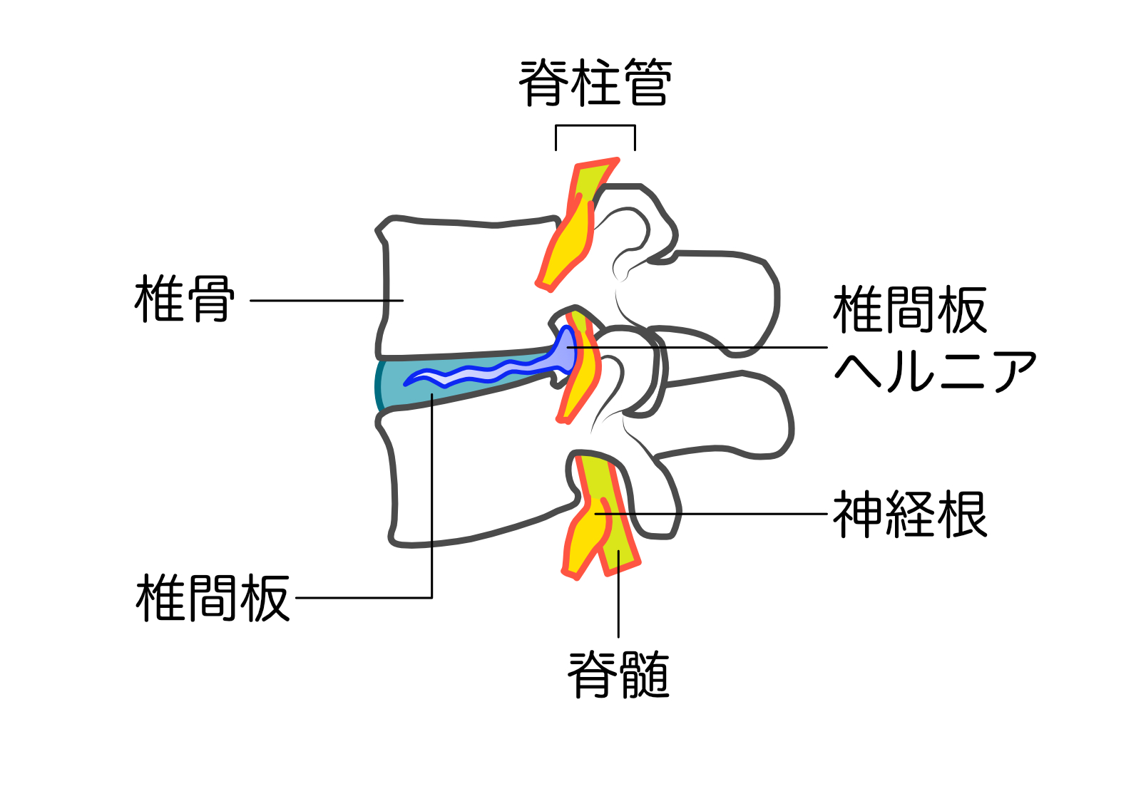 ダウンロード