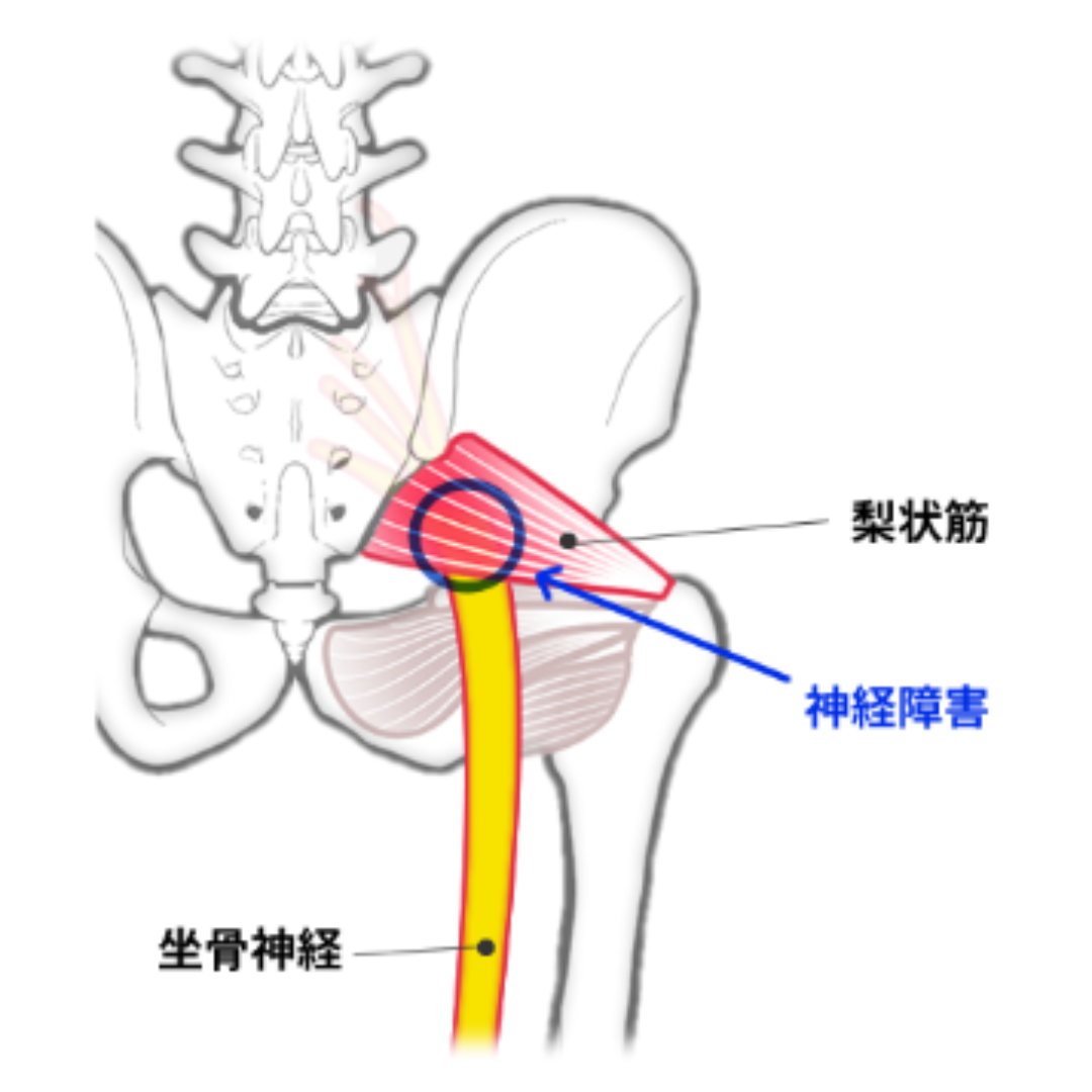 SEOコンテンツのH3見出し1